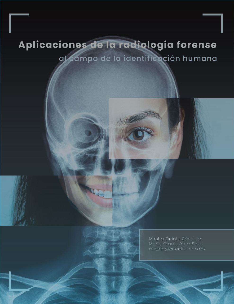 Portada del Artículo Aplicaciones de la radiología forense