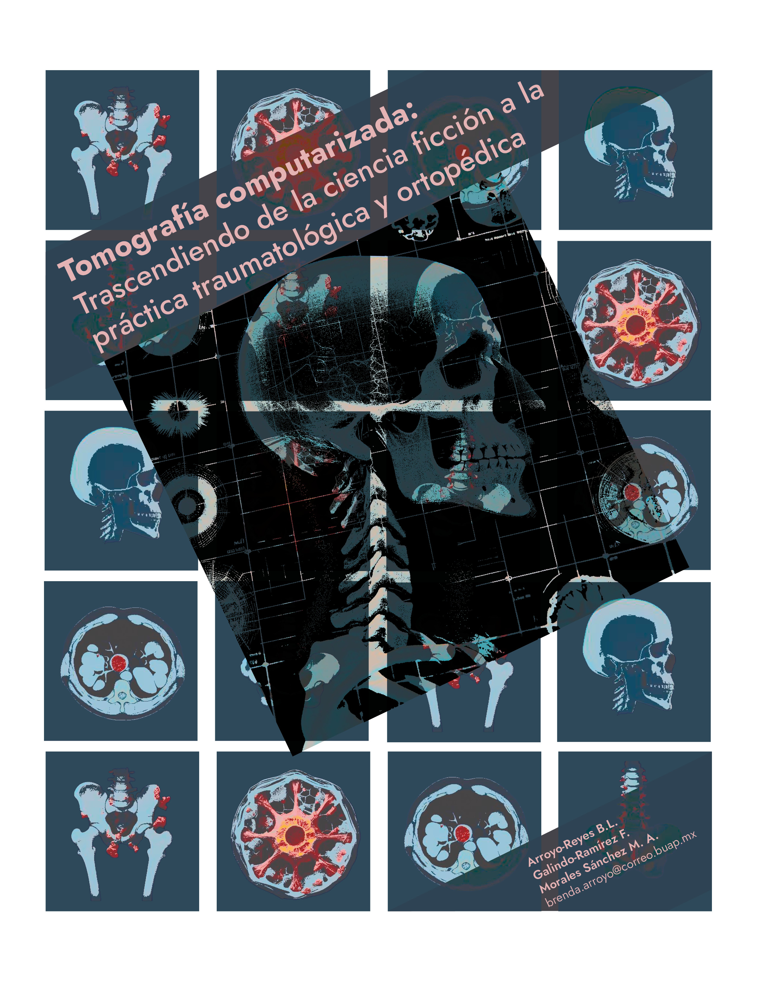 Portada del Articulo Tomografía Computarizada Ortopedia